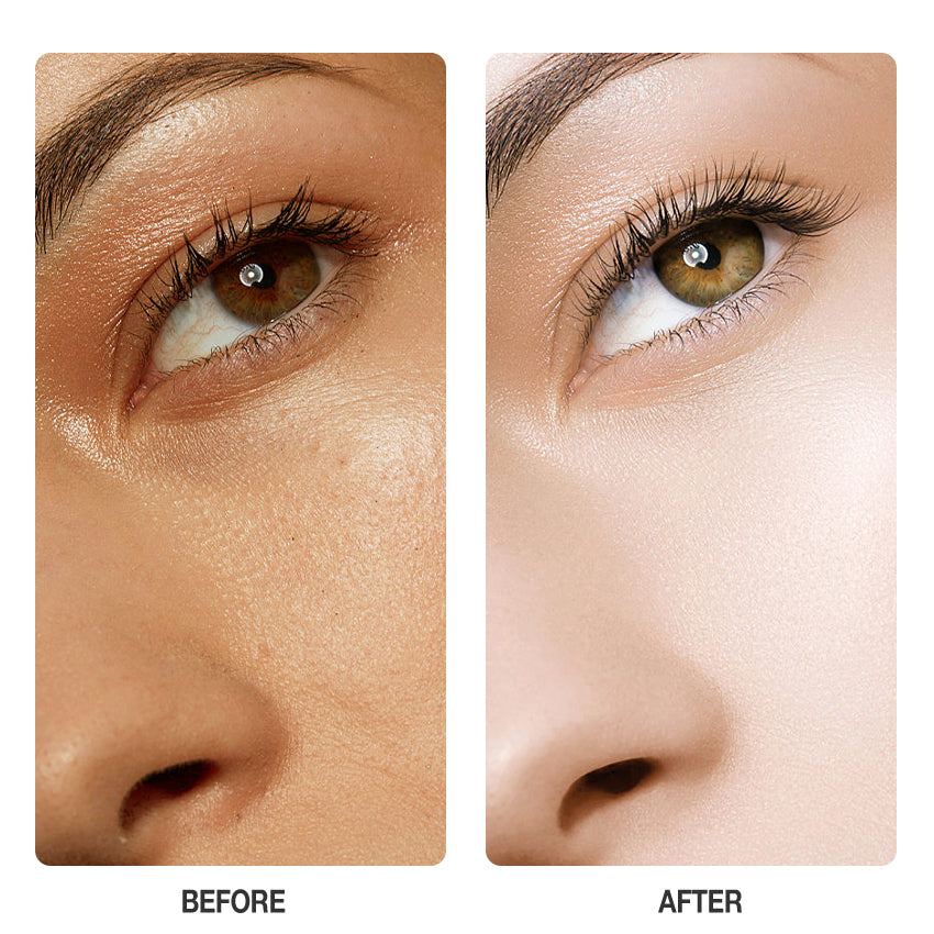 Skinever Vitamin C Brightening Serum - 20ml