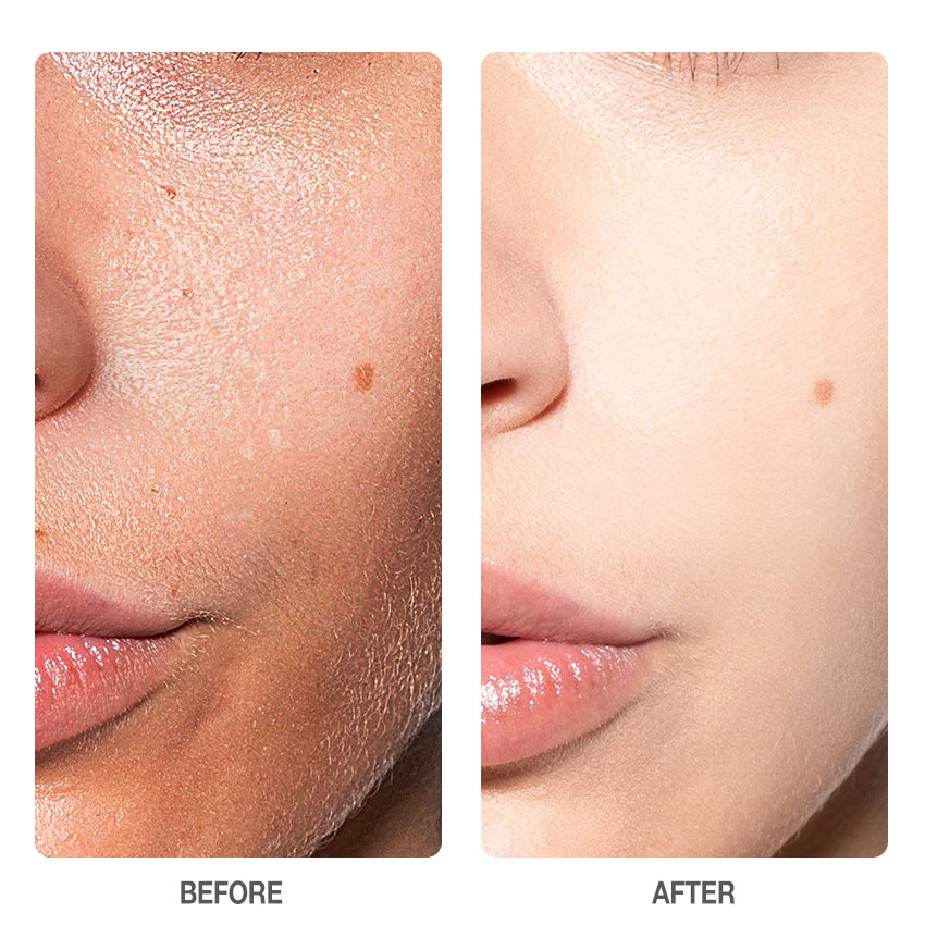 Skinever Salicylic Acid Refreshing Acne Skin Pads - 130ml