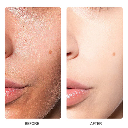 Skinever Salicylic Acid Refreshing Acne Skin Pads - 130ml