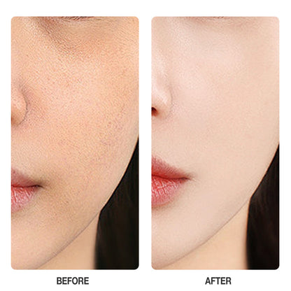 Skinever Vitamin C Brightening Toner - 100ml