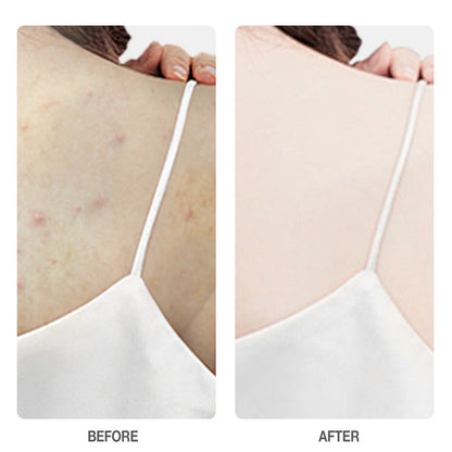 Skinever Salicylic Acid Weightless Exfoliating Body Lotion - 100ml